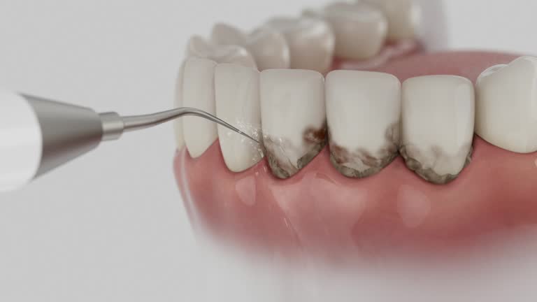 Trusted Tooth Extraction service in Jonesboro, GA - Dentist Open Now